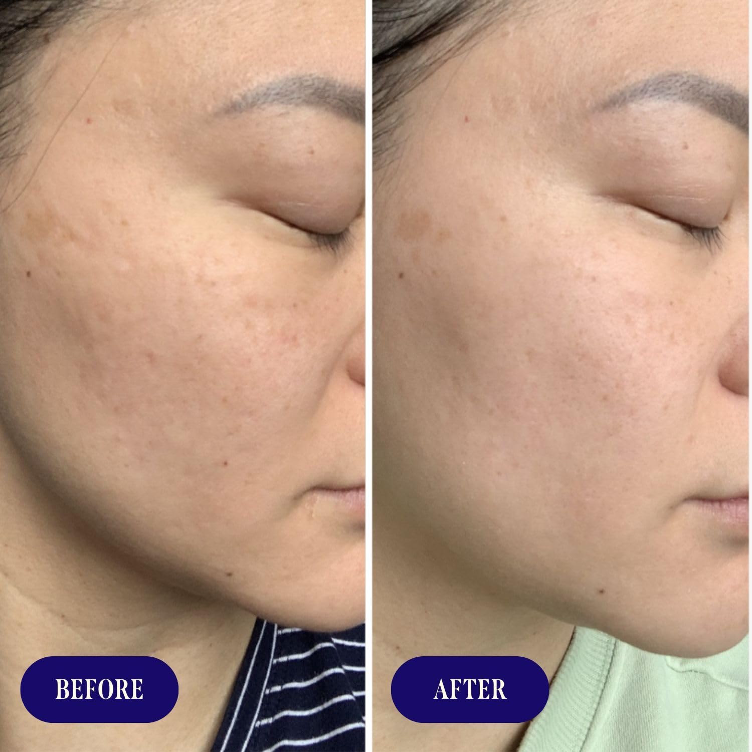 Ultra-Hydrating Cream