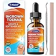Ingrown Toenail Relief: Ingrown Toenail Drops for Men Women - Ingrown Toenail Removal Kit - Ingrown Toenail Corrector Drops -