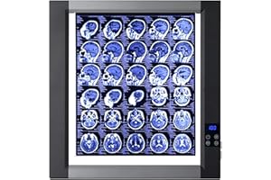 Professional X-Ray LED Film Viewer Portable Slide Viewer Light Pad Acrylic Panel and Aluminum Frame Adjustable Brightness X-r