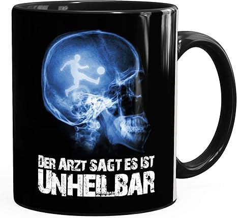 Amazon De Moonworks Kaffee Tasse Xray Der Arzt Sagt Es Ist Unheilbar Hobby Schadel Rontgenbild Fussball Soccer Fussballer Geschenk Tasse Schwarz Unisize