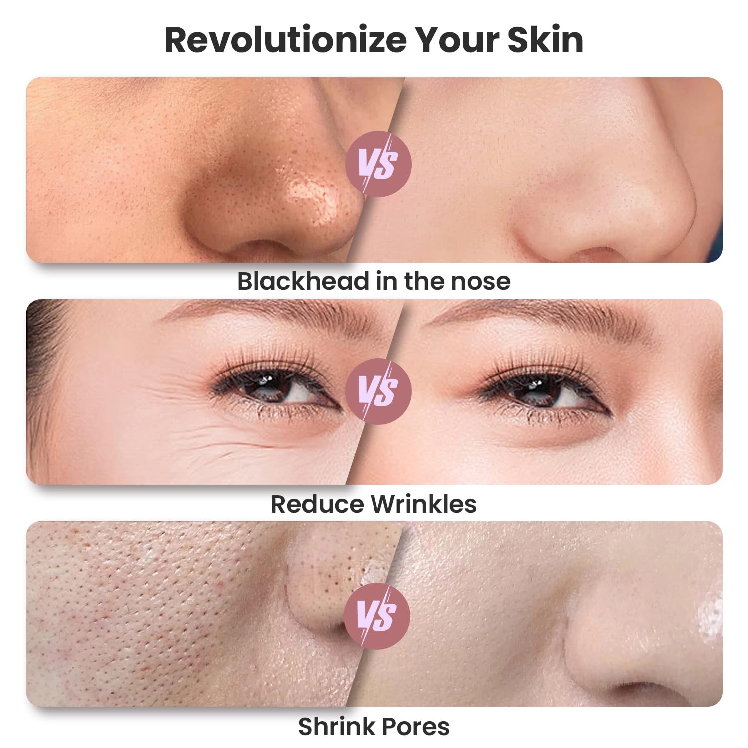 UNOISETION Diamond Microdermabrasion Machine, Rechargeable Cordless Dermabrasion Facial Machine with 3 Levels, Professional Portable Home Travel Microdermabrasion Device