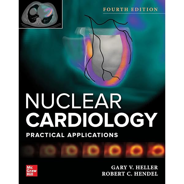 Amazon.com: Nuclear Cardiology and Multimodal Cardiovascular