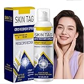 NTYNLe Chill Erase Bump Renewal Spray, Advanced Salicylic Acid Body Spray 2%, Reduces Skin Imperfections, Absorbs Quickly, Natural Skin Serum Suitable for All Skin Types (1Pcs)