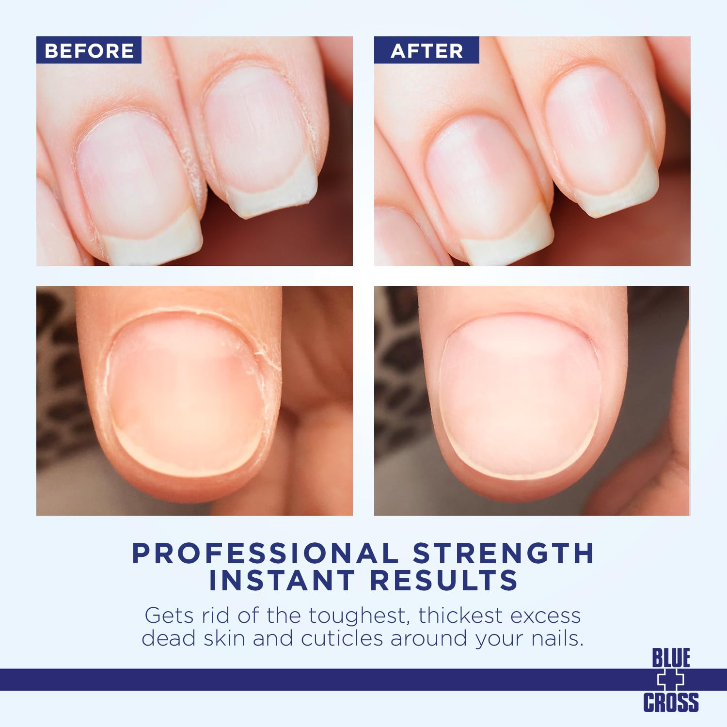 Blue Cross Professional Nail Care, Hydrating, Moisturizing