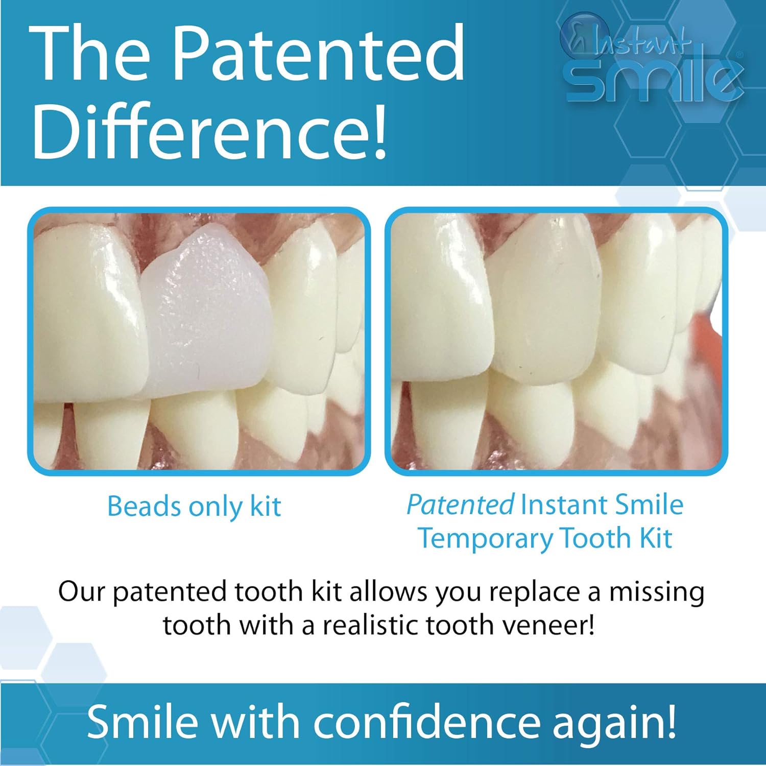 Instant Smile Complete Your Smile Temporary Tooth Replacement Kit - Replace a missing tooth in minutes - Patented : Beauty