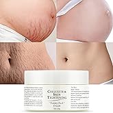 Stretch Marks Removal Cream for Pregnancy Massages Body & Reduces Scar Appearance,Gentle Stretch Marks Eradication Body Skincare Firming (120g/4.23oz)