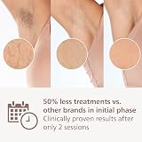 Philips Lumea 7000 Series IPL Hair Removal Device BRI921/00 view 4