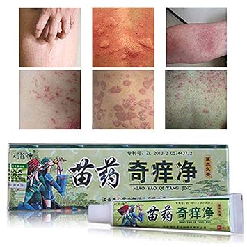 Amazon Com 1pcs Hmong Antifungal Cream Inhibition Foot Ringworm