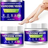 Yongsenina Varicose Veins Cream, Vein Cream & Spider Veins Treatment for Legs, Improves Blood Circulation and Relief From Heavy Fatigued Leg, Refreshing and Non-Sticky, 2PK
