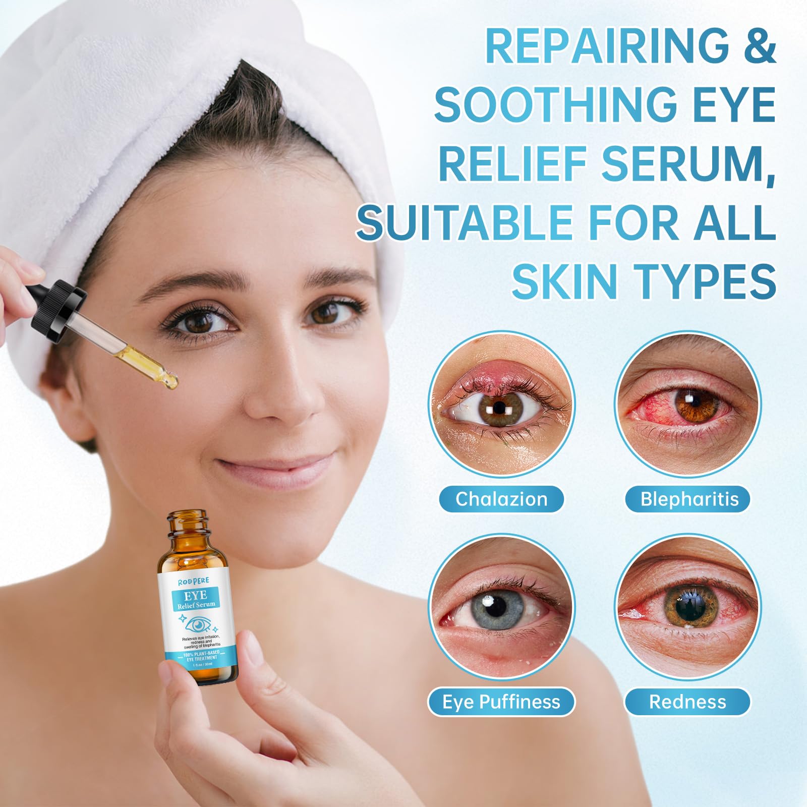 Eye Treatment Serum, Chalazion & Blepharitis Remover With Avocado Oil, Buckthorn Oil For Eyelid, 30ML Tea Tree & Caffeine Eye Serum For Redness, Puffiness, Eye Relief.