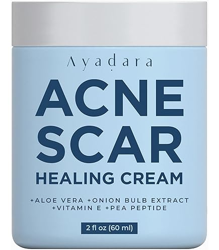 AYADARA Cystic, Hormonal & Severe Acne Spot Treatment, Natural Pimple Cream With Salicylic Acid Tea Tree For Teens Adults Zit Milia Blemish Minimizer For A Clean Face Body 150 Treatments