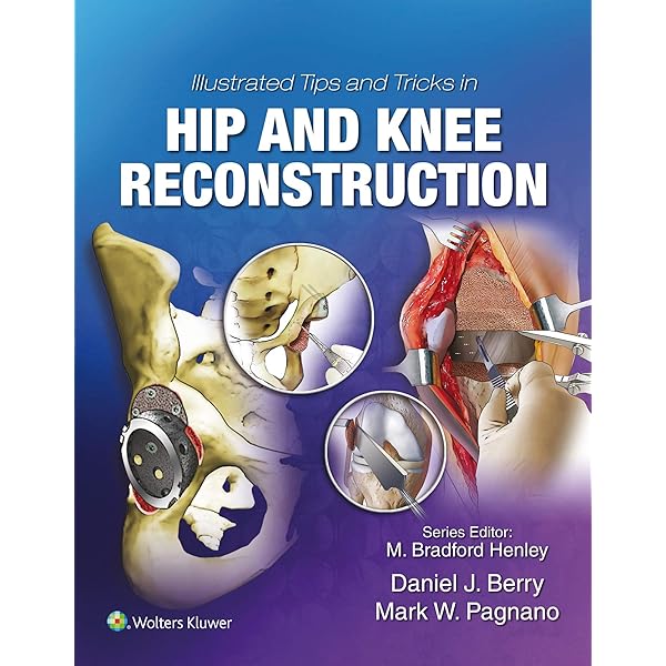 Amazon.com: Harborview Illustrated Tips and Tricks in Fracture