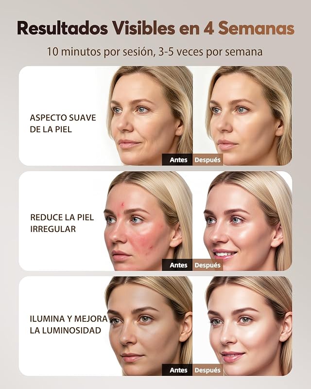 Máscara LED Facial con 4 Modos para Cuidado Facial en Casa, NVV10