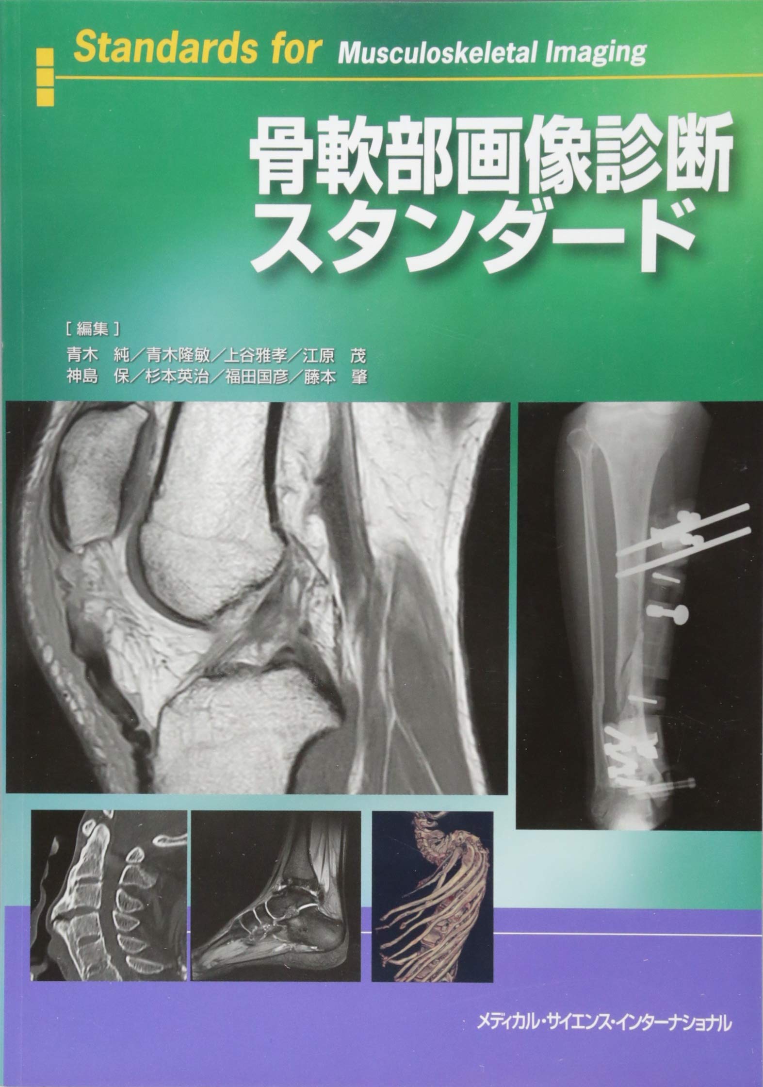 骨軟部腫瘍外科 診療内容 岐阜大学医学部整形外科