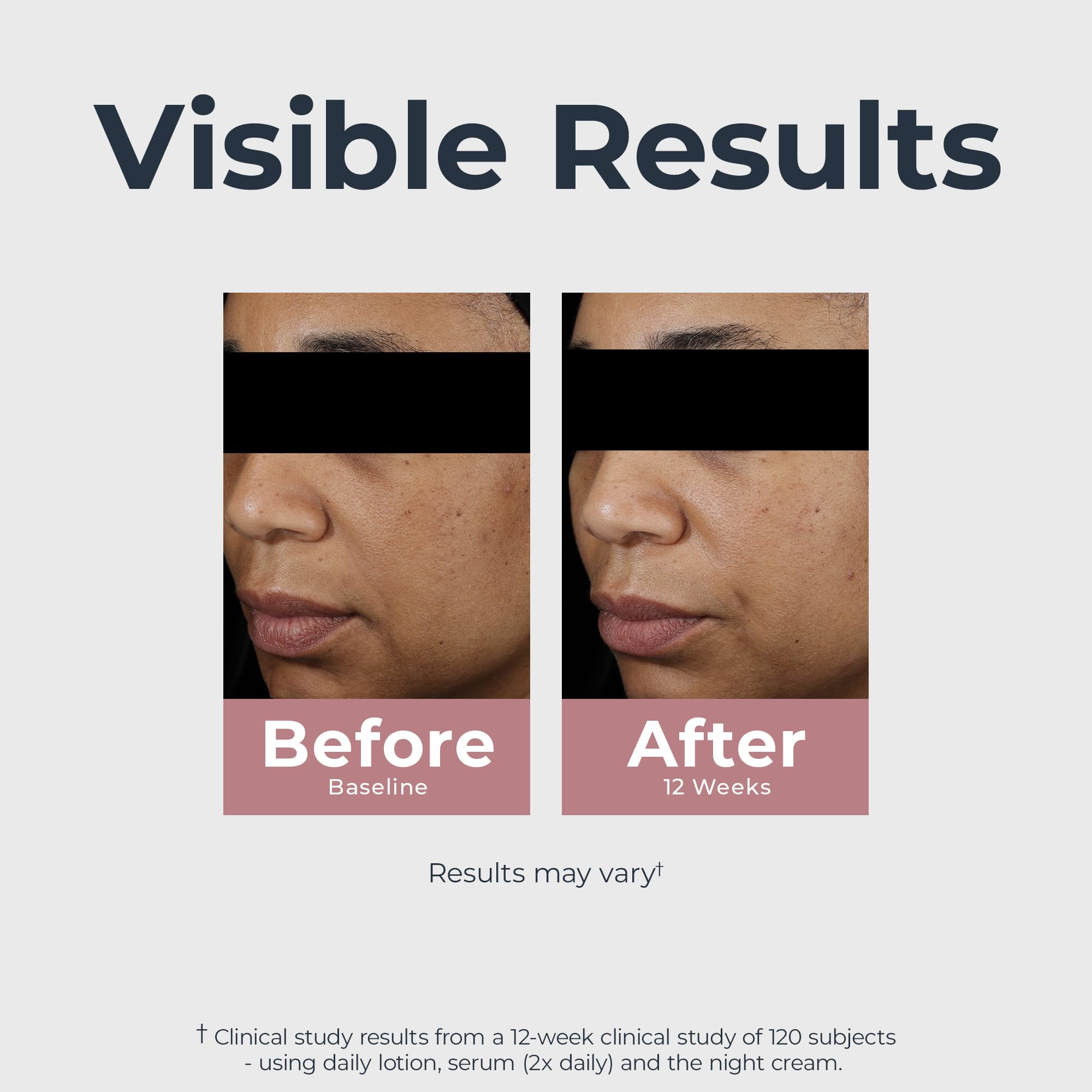 Eucerin Radiant Tone Dual Serum Dark Spot Corrector, Dark Spot Serum with Thiamidol and Hyaluronic Acid, Helps Visibly Reduce the Look of Dark Spots, Holiday Gifts for Self Care, 1 Fl Oz Bottle