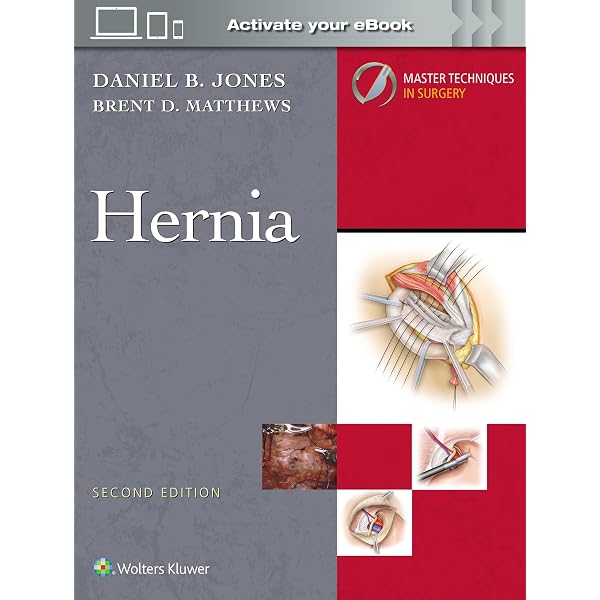 The Adult Hip: Hip Arthroplasty Surgery Print + eBook with