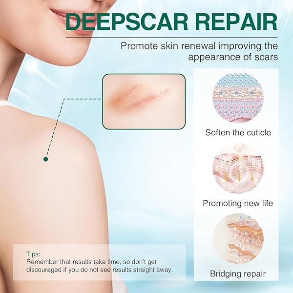 SILICONE SCAR GEL, ADVANCED SCAR TREATMENT CREAM GEL, KELOID BUMP REMOVAL FOR OLD AND NEW SCARS, SURGICAL SCARS, C-SECTION, BURN, STRETCH MARK 1.7 OZ (50G)