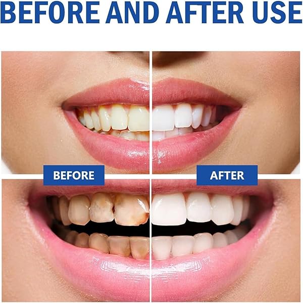 2PC PROBIOTIC SP-10 TOOTHPASTE, SP-10 ULTRA WHITENING TOOTHPASTE, SP-10 PROBIOTIC STAIN REMOVAL TOOTHPASTE, FRESH BREATH,DEEP CLEANING CARE TOOTHPASTE