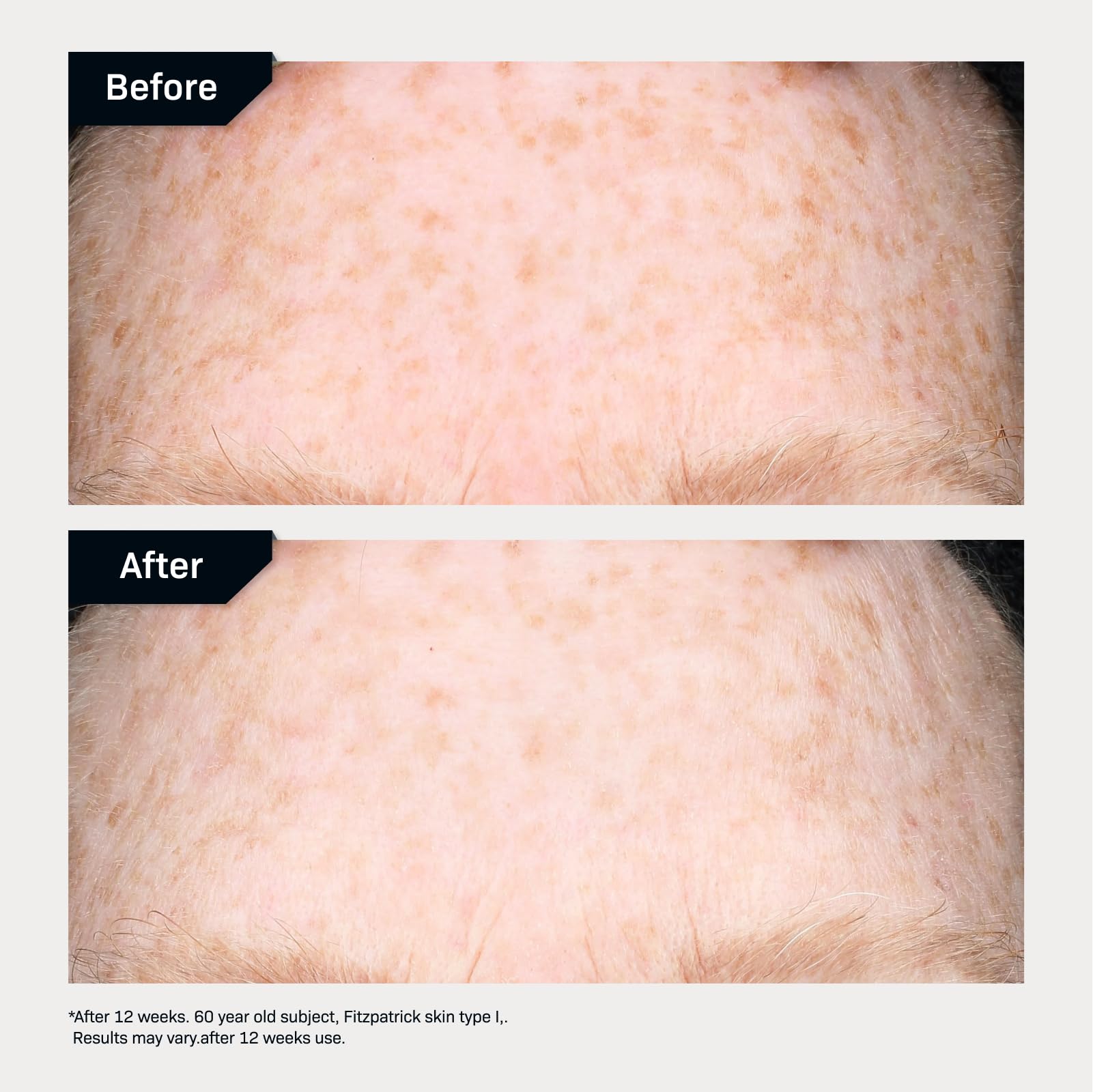 Revision Skincare Intellishade® TruPhysical Clear SPF 50, 100% Mineral Face Sunscreen, Oil-Free Anti-Aging Moisturizer with SPF and Vitamin C, Invisible Sunscreen for Sensitive Skin, 1.7 oz