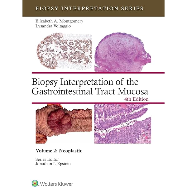 Amazon.com: Surgical Pathology of the Liver eBook : Torbenson