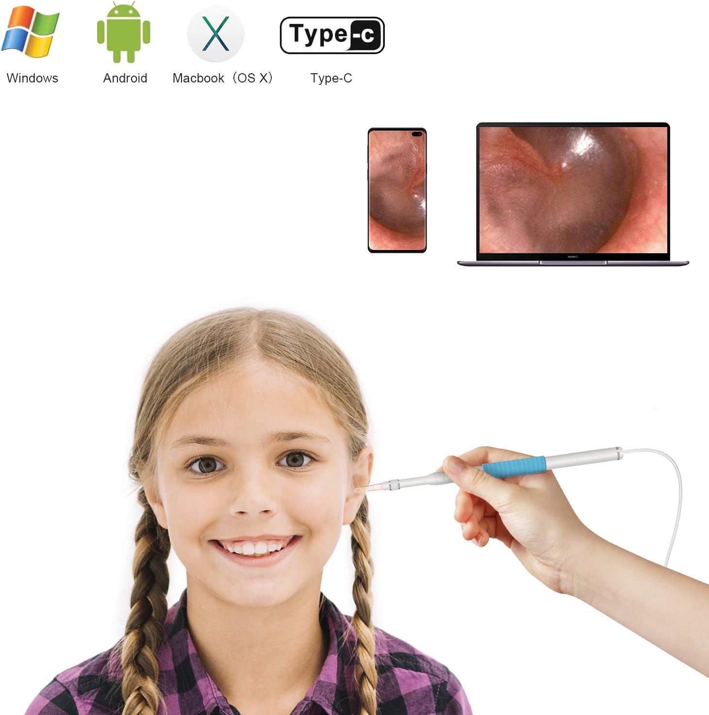 Ear Otoscope | HD Visual Ear Cleaner Ear Scope Endoscope Camera Earwax Remover with 6 LED Lights | for Adult Children Kids Veterinary | Android Smartphones, Windows, MAC PC Computer | Avalon Home