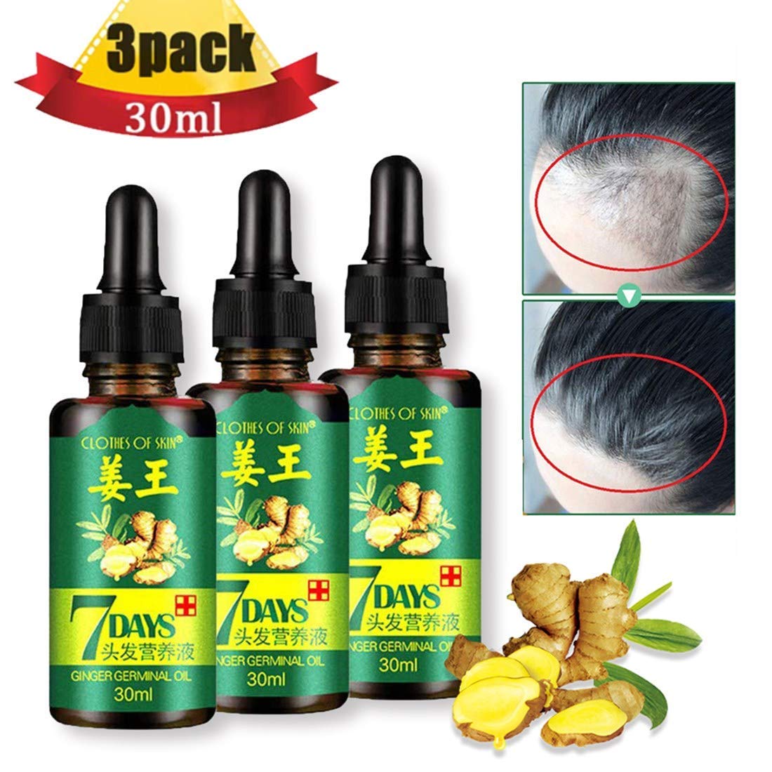 3 PACK Ginger Germinal Oil, 2020 Hair Growth Ginger Essential Oil Hair Growth Oil Hair Loss Treatment For Women and Men : Beauty