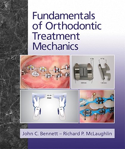 Download Fundamentals of Orthodontic Treatment Mechanics PDF