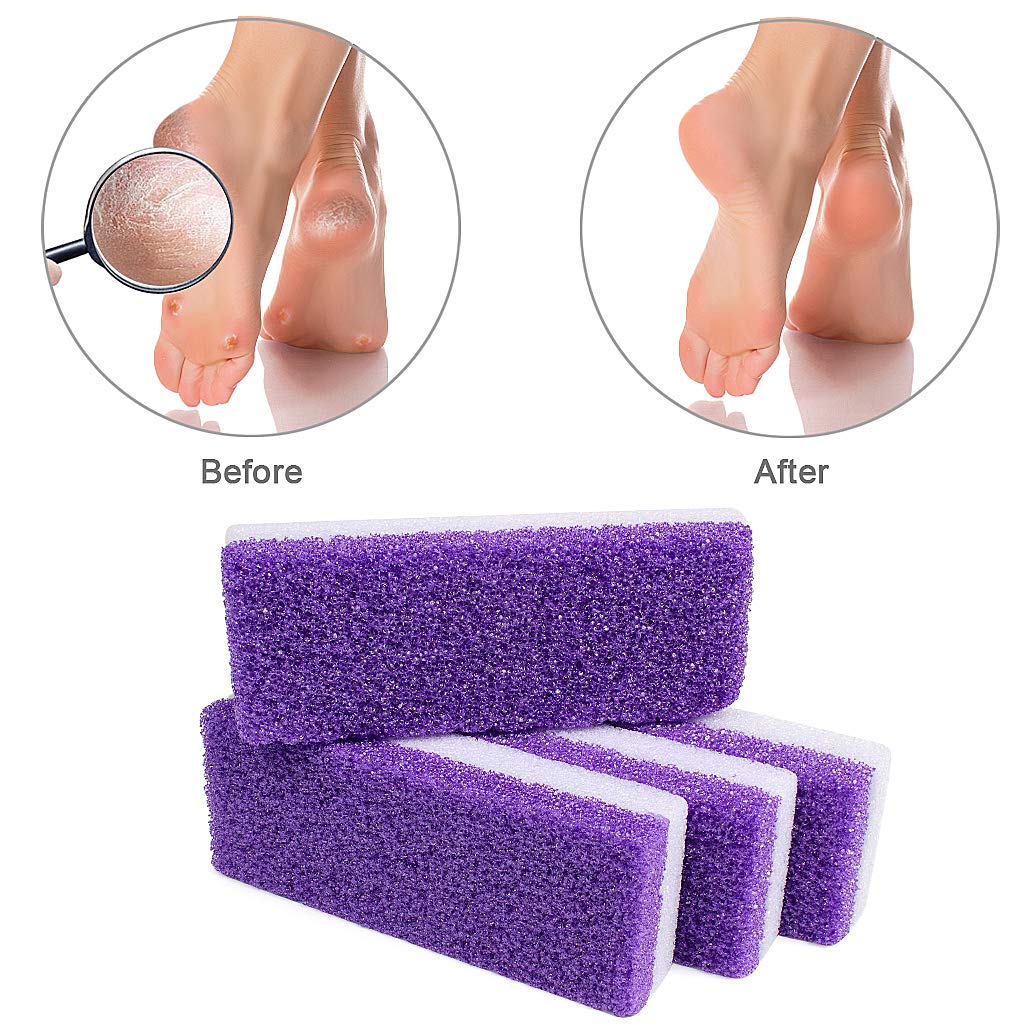 Edealing Foot Pumice Stone,4 Packs Double Sided Hard Skin Callus Remover, Dead Skin Scrubber Pedicure Tools for Foot Caring-Purple: Beauty