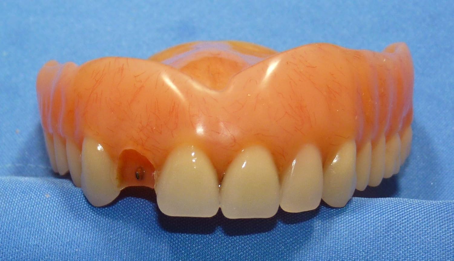 Denture Repair Lab Denture Tooth Repair Repair Broken