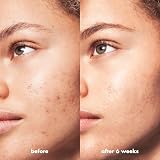 e.l.f. SKIN Blemish Breakthrough Calming Water Cream Face Moisturiser For Acne view 5