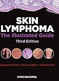Skin Lymphoma: The Illustrated Guide