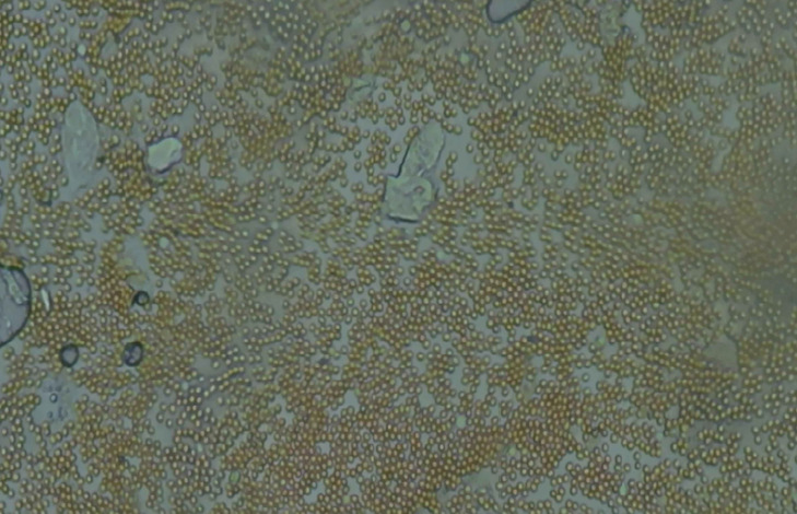 $22/mo - Finance LCD Digital Microscope - 2000X Biological Microscope ...