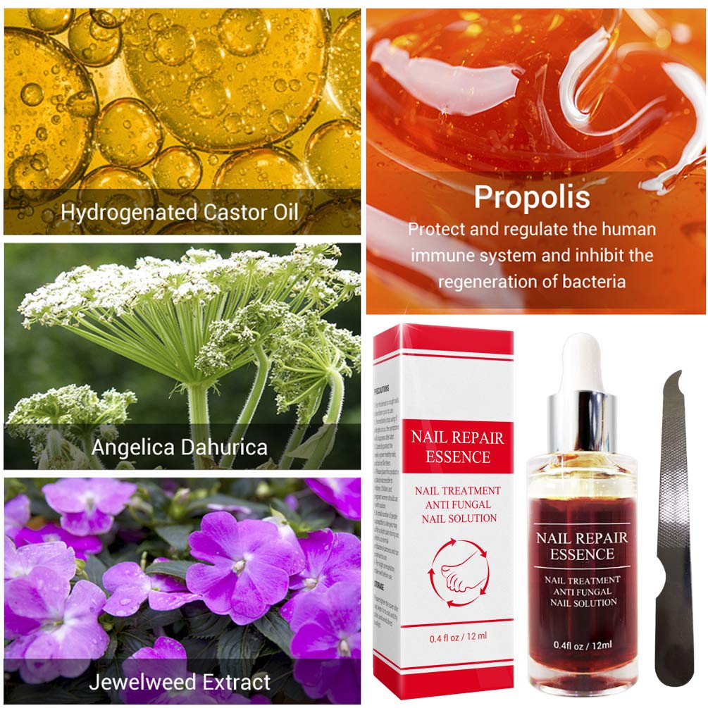Fanmin Toenail and Nail Repair Essence, Remove Paronychia Onychomycosis Toe, Toenail and Nail Care Solution, Toenail and Nail Renewal, Fixes and Restores Discolored and Damaged Nails : Beauty