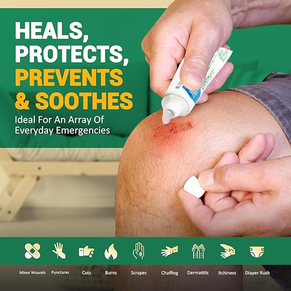 MED PRIDE BACITRACIN WITH ZINC ANTIBIOTIC OINTMENT 4 PACK OF 1 OZ TUBES, FIRST AID FOR SKIN IRRITATIONS, CUTS, BURNS, DIAPER RASH, DERMATITIS, ECZEMA