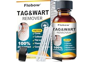 REAUA Skin Tag Removal Kit - 17% Salicylic Acid Wart Remover Freeze Off, Fast-Acting Skin Tag Remover for Toes Feet Wart Freeze Off for Plantar, Corn Wart, Flat, Common - for Men and Women (30ml01)