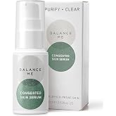 Balance Me Congested Skin Face Serum, 0.5 fl oz | Natural Acne Treatment for Face, Non-Drying Spot Serum &amp; Pimple Cream, Oily, Combination &amp; Sensitive Skin