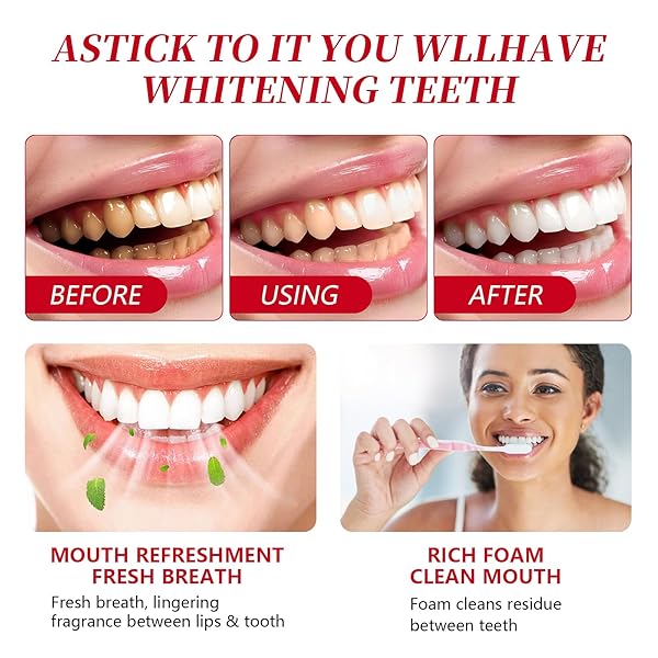 SP-10 PROBIOTIC WHITENING TOOTHPASTE – ULTRA WHITENING & STAIN REMOVAL, DEEP CLEANING, FRESH BREATH FORMULA WITH PROBIOTICS (1)