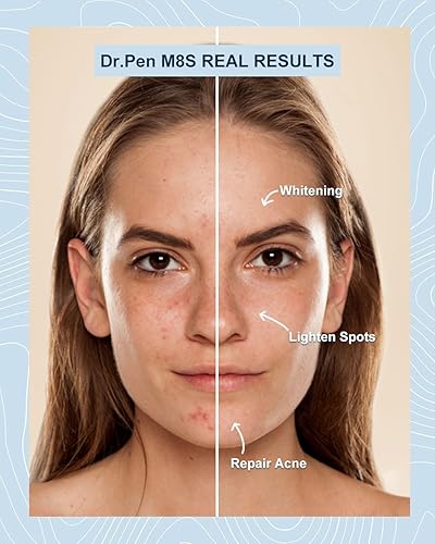 Ultima M8S Microneedling Pen, Wireless Microneedle Skin