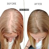 THICK FIBER Hair Fibres 25g Medium Blonde Hair Thickener for Thinning Hair view 4