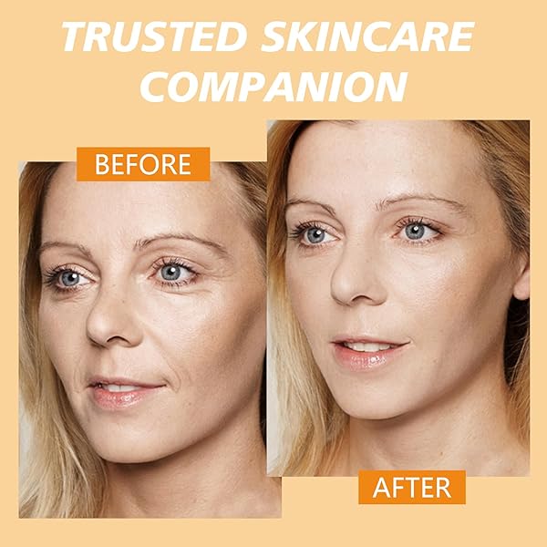 GENERIC DEBAIY 3 PACK VITAMIN C SERUM FOR FACE RESTORES SKIN TONE PROMOTES EPIDERMAL BARRIER REPAIR (1FL OZ | 30ML)