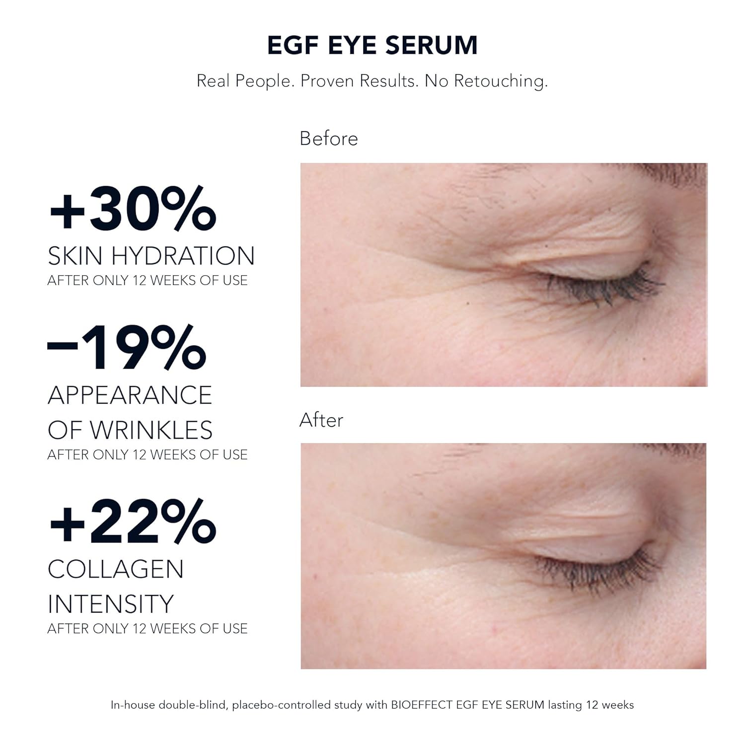 bioeffect serum before and after