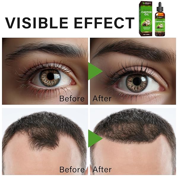 INSCAPE DATA CASTOR OIL, 100% PURE COLD PRESSED BLACK CASTOR OIL FOR HAIR, EYELASHES, EYEBROWS – DRY SKIN MOISTURIZER AND BODY OIL