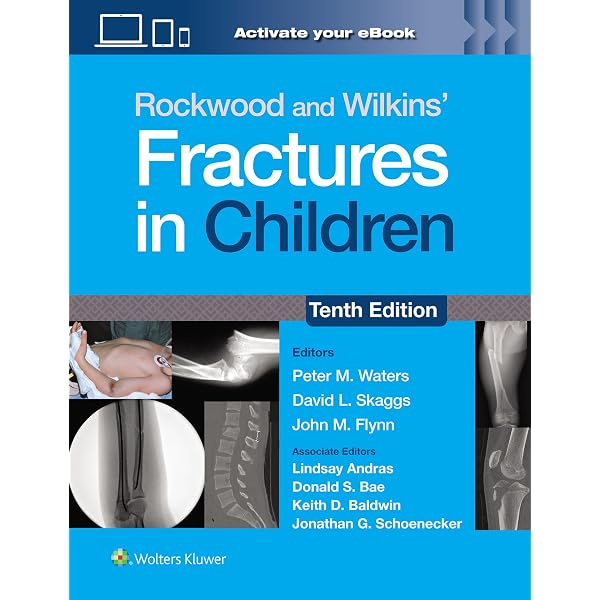 Amazon.com: Rockwood and Green's Fractures in Adults