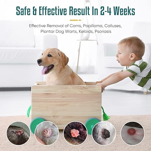 NHZ Dog Skin Tag Remover, Dog Wart Remover, Pets Skin Tag Removal