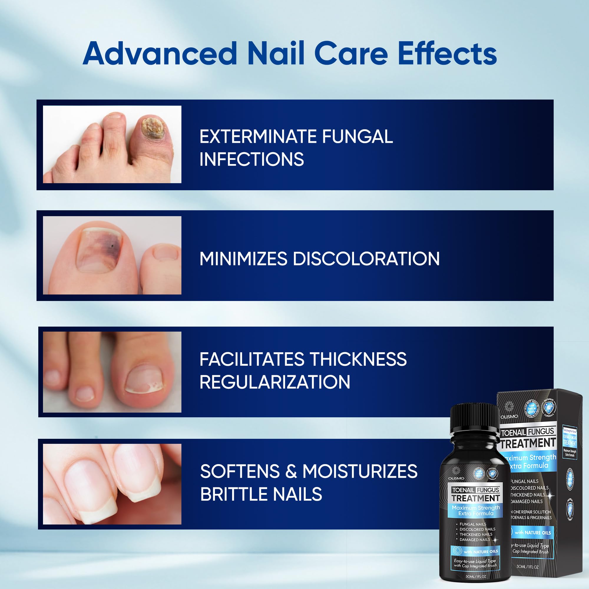 Toenail Fungus Treatment, Nail Fungus Treatment for Toenail, Toe Nail Fungus Treatment Extra Strength for Woman and Man, Nail Fungus Treatment 30ML (1 FLOZ) - Image 3
