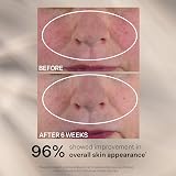 StriVectin Advanced Retinol Nightly Multi-Ccorrect Serum 1 Oz 30ml view 7