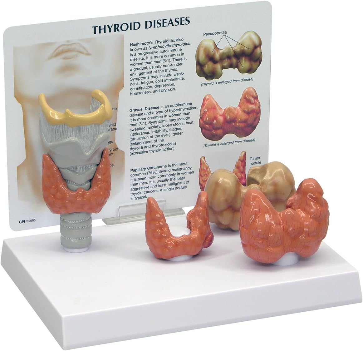3B Scientific Thyroid Model