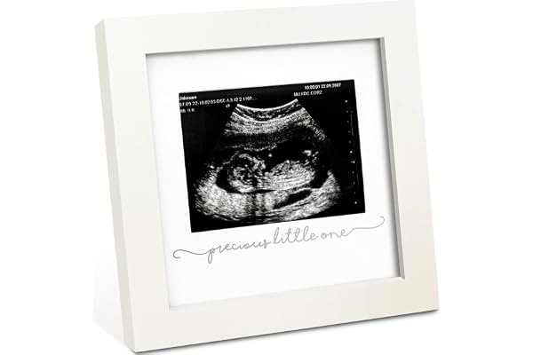 KeaBabies Baby Sonogram Picture Frame - Modern Ultrasound Picture Frames for Mom to Be, First Pregnancy Gifts for Expecting M