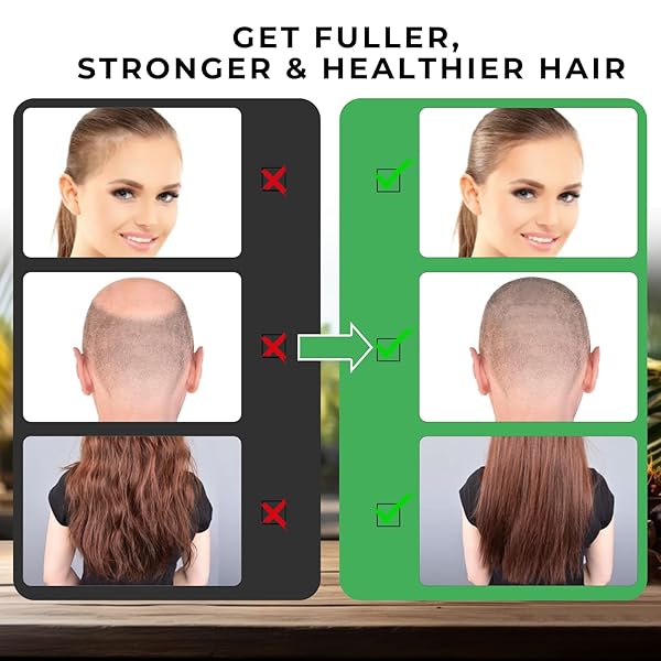 MYSENSE RAW BATANA OIL, 100% PURE UNREFINED AND ORGANIC GROWTH OIL FROM HONDURAS, SCALP CARE FOR WOMEN & MEN, PREVENT HAIR LOSS, PROMOTE HAIR THICKNESS