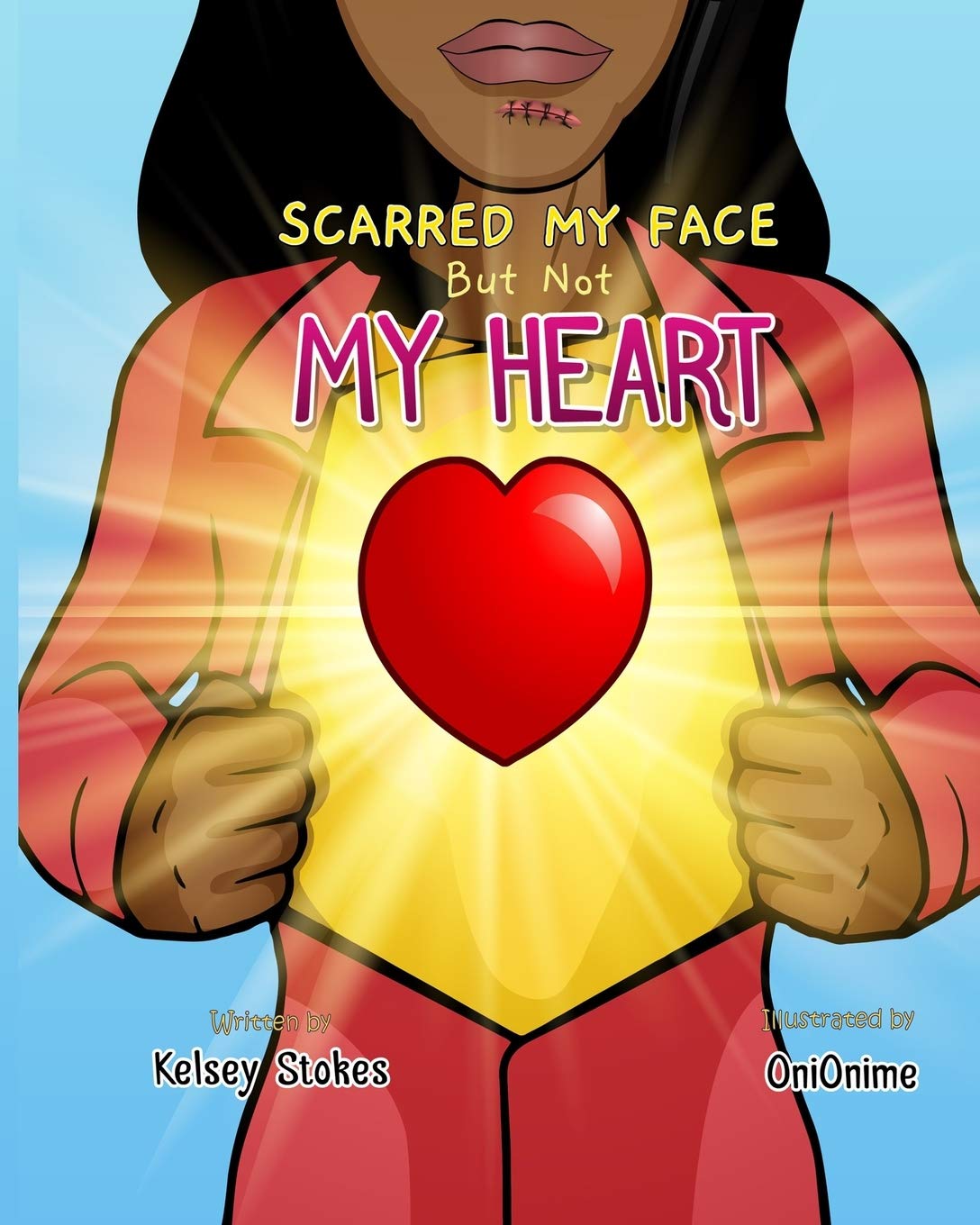 Amazon Com Scarred My Face But Not My Heart 9798727946978 Stokes Kelsey Books